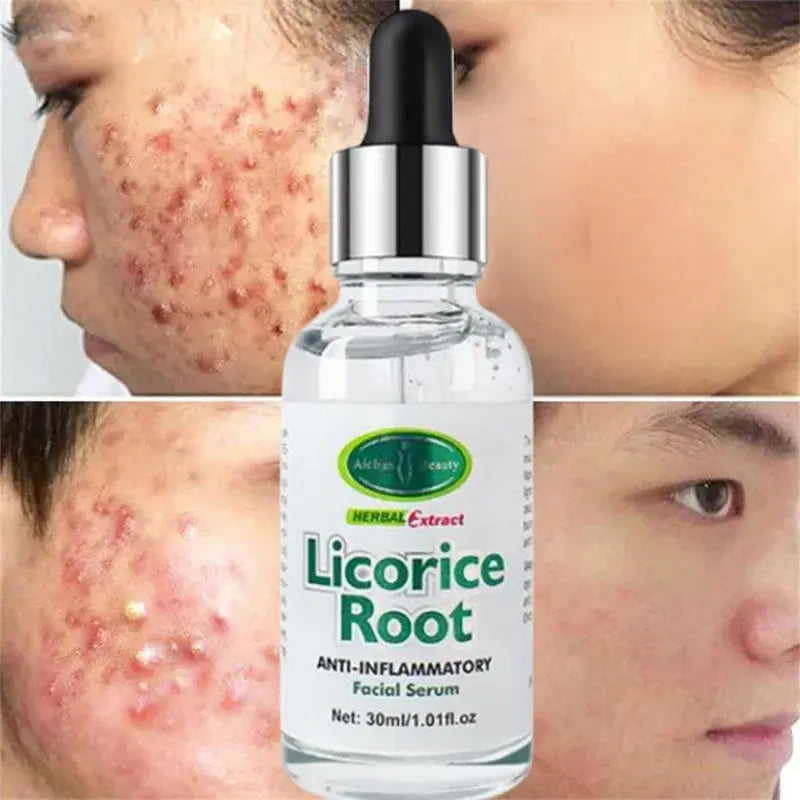 Sérum Éclaircissant Anti-Inflammatoire pour le Visage à la Racine de Réglisse AICHUN BEAUTY 30mL Oriental Cosmetics